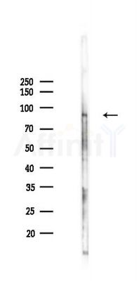 Phospho-NR3C1 (Ser226) Antibody - Western blot analysis of lysates from PC12 cells(UV,30min treatment), using Phospho-NR3C1 (Ser226) Antibody at 1/1000 dilution.