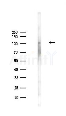 Phospho-TrkA (Tyr680+Tyr681) Antibody - Western blot analysis of lysates from PC12 cells(UV,30min treatment), using Phospho-TrkA (Tyr680+Tyr681) Antibody at 1/1000 dilution.