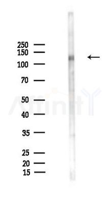 Phospho-TrkA (Tyr680+Tyr681) Antibody - Western blot analysis of lysates from HUVEC cells(UV,30min treatment), using Phospho-TrkA (Tyr680+Tyr681) Antibody at 1/1000 dilution.