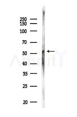 Phospho-p53 (Ser392) Antibody - Western blot analysis of lysates from MDA-MB-231 cells, using Phospho-p53 (Ser392) Antibody at 1/1000 dilution.
