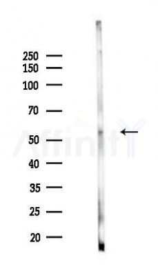 Phospho-p53 (Ser15) Antibody - Western blot analysis of lysates from Mouse testis, using Phospho-p53 (Ser15) Antibody at 1/1000 dilution.