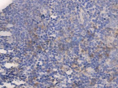 Phospho-p53 (Ser315) Antibody - AF3079 at 1/100 staining human normal tonsil tissue by IHC-P.