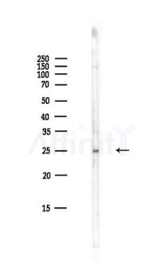 Phospho-HSP27 (Ser82) Antibody - Western blot analysis of lysates from HepG2 cells(LPS,4h treatment), using Phospho-HSP27 (Ser82) Antibody at 1/1000 dilution.
