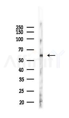 Phospho-Lck (Tyr393)[Tyr394] Antibody - Western blot analysis of lysates from B16F10-LUC cells(uv30min treatment), using Phospho-Lck (Tyr393)[Tyr394] Antibody at 1/1000 dilution.