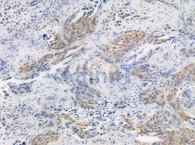 Phospho-eIF4E (Ser209) Antibody - AF3110 at 1/100 staining human normal placenta tissue by IHC-P.