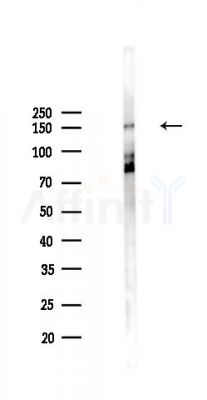 Phospho-MCSF Receptor (Tyr809) Antibody - Western blot analysis of lysates from PC12 cells(UV,30min treatment), using Phospho-MCSF Receptor (Tyr809) Antibody at 1/1000 dilution.