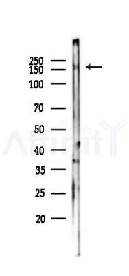 Phospho-Ret (Tyr1062) Antibody - Western blot analysis of lysates from 293 cells(UV,30min treatment), using Phospho-Ret (Tyr1062) Antibody at 1/1000 dilution.