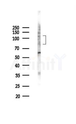 Phospho-SP1 (Thr453) Antibody - Western blot analysis of lysates from K562 cells(UV,30min treatment), using Phospho-SP1 (Thr453) Antibody at 1/1000 dilution.