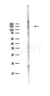 Phospho-c-Met (Tyr1349) Antibody - Western blot analysis of lysates from PC12 cells(LPS,4h treatment), using Phospho-c-Met (Tyr1349) Antibody at 1/1000 dilution.