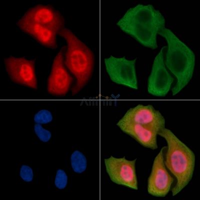 Phospho-Bcl-2 (Ser87) Antibody - AF3138 staining Hela cells(30min of UV treatment) by IF/ICC.