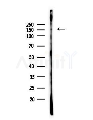 Phospho-Bcr (Tyr177) Antibody - Western blot analysis of lysates from EC304 cells(heat-shock,45min treatment), using Phospho-Bcr (Tyr177) Antibody at 1/1000 dilution.