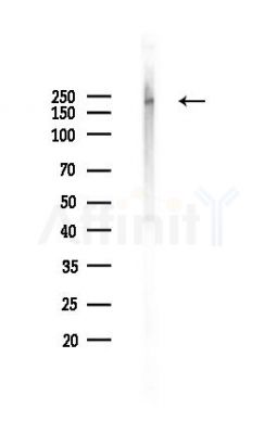 Phospho-Bcr (Tyr360) Antibody - Western blot analysis of lysates from K562 cells(UV,30min treatment), using Phospho-Bcr (Tyr360) Antibody at 1/1000 dilution.