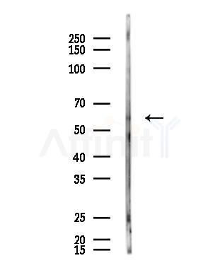 Phospho-Src (Ser75) Antibody - Western blot analysis of lysates from COLO205 cells(LPS,4h treatment), using Phospho-Src (Ser75) Antibody at 1/1000 dilution.