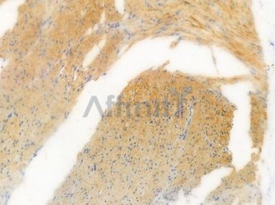 Phospho-Ezrin (Thr567) Antibody - AF3172 at 1/100 staining human normal colon tissue by IHC-P.