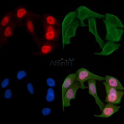 Phospho-ATF2 (Ser112/Ser94) Antibody - AF3177 staining Hela cells(30min of UV treatment) by IF/ICC.