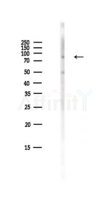 Phospho-PKC alpha (Thr638) Antibody - Western blot analysis of lysates from HepG2 cells(LPS,4h treatment), using Phospho-PKC alpha (Thr638) Antibody at 1/1000 dilution.