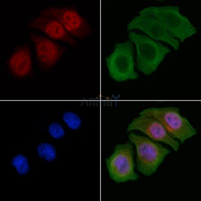 Phospho-CEBP Beta (Thr235/Thr188) Antibody - AF3202 staining Hela cells by IF/ICC.