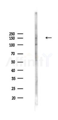 Phospho-PLCG1 (Tyr783) Antibody - Western blot analysis of lysates from PC12 cells(UV,30min treatment), using Phospho-PLCG1 (Tyr783) Antibody at 1/1000 dilution.