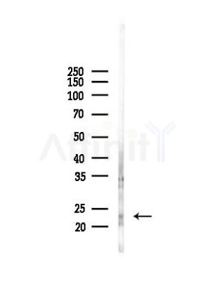 Phospho-TNNI3 (Ser44) Antibody - Western blot analysis of lysates from Mouse brain, using Phospho-TNNI3 (Ser44) Antibody at 1/1000 dilution.