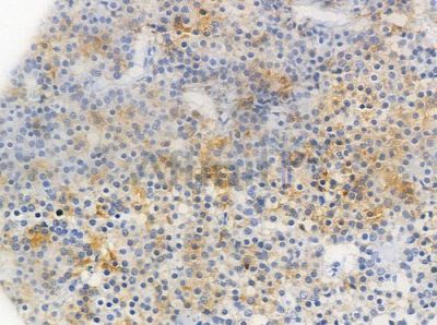 Phospho-TNNI3 (Ser44) Antibody - AF3215 at 1/100 staining human pituitary adenoma by IHC-P.