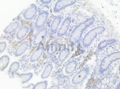 Phospho-p70 S6 Kinase (Thr421)[Thr444] Antibody - AF3231 at 1/100 staining human normal colon tissue by IHC-P.