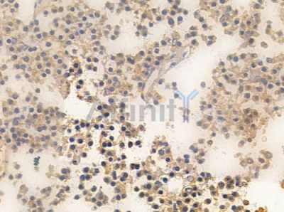 Phospho-SHP1 (Tyr536) Antibody - AF3244 at 1/100 staining human pituitary adenoma by IHC-P.