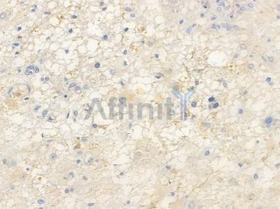 Phospho-SHP1 (Tyr536) Antibody - AF3244 at 1/100 staining human astrocytoma by IHC-P.