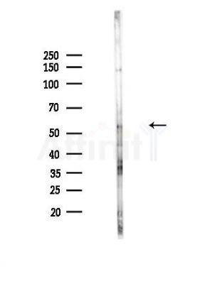Phospho-CDC25A (Ser178) Antibody - Western blot analysis of lysates from Hela cells(heat-shock,45min treatment), using Phospho-CDC25A (Ser178) Antibody at 1/1000 dilution.