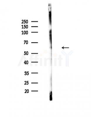 Phospho-CDC25B (Ser353) Antibody - Western blot analysis of lysates from Hela cells(heat-shock,45min treatment), using Phospho-CDC25B (Ser353) Antibody at 1/1000 dilution.