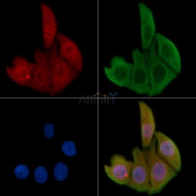 Phospho-AKT1 (Thr450) Antibody - AF3259 staining Hela cells by IF/ICC.