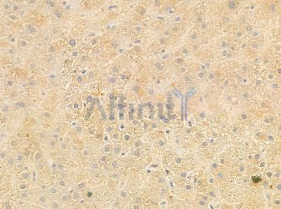 Phospho-iNOS (Tyr151) Antibody - AF3270 at 1/100 staining human normal liver tissue by IHC-P.