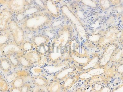 Phospho-VEGFR2 (Tyr951) Antibody - AF3281 at 1/100 staining human normal kidney tissue by IHC-P.