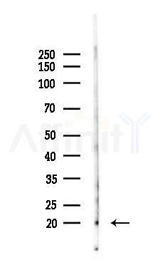Phospho-Synuclein alpha (Tyr133) Antibody - Western blot analysis of lysates from Mouse testis, using Phospho-Synuclein alpha (Tyr133) Antibody at 1/1000 dilution.