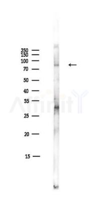 Phospho-STAT1 (Tyr701) Antibody - Western blot analysis of lysates from Mouse liver, using Phospho-STAT1 (Tyr701) Antibody at 1/1000 dilution.