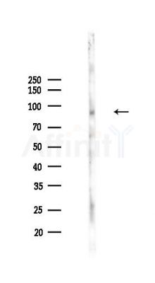 Phospho-STAT6 (Tyr641) Antibody - Western blot analysis of lysates from PC12 cells(UV,30min treatment), using Phospho-STAT6 (Tyr641) Antibody at 1/1000 dilution.