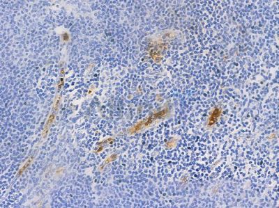 Phospho-ZAP70 (Tyr493) Antibody - AF3313 at 1/100 staining human normal tonsil tissue by IHC-P.