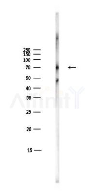 Phospho-Paxillin (Tyr118) Antibody - Western blot analysis of lysates from Mouse liver, using Phospho-Paxillin (Tyr118) Antibody at 1/1000 dilution.