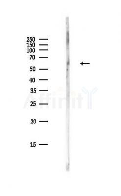 Phospho-Paxillin (Tyr118) Antibody - Western blot analysis of lysates from HepG2 cells(LPS,4h treatment), using Phospho-Paxillin (Tyr118) Antibody at 1/1000 dilution.
