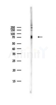 Phospho-Paxillin (Tyr118) Antibody - Western blot analysis of lysates from PC12 cells(LPS,4h treatment), using Phospho-Paxillin (Tyr118) Antibody at 1/1000 dilution.