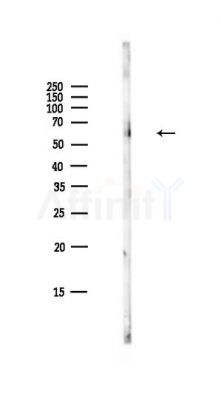 Phospho-Paxillin (Tyr31) Antibody - Western blot analysis of lysates from HepG2 cells(LPS,4h treatment), using Phospho-Paxillin (Tyr31) Antibody at 1/1000 dilution.