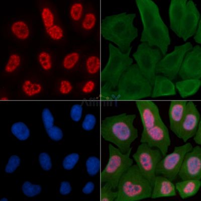 Phospho-Caspase 9 (Thr125) Antibody - AF3348 staining Hela cells by IF/ICC.