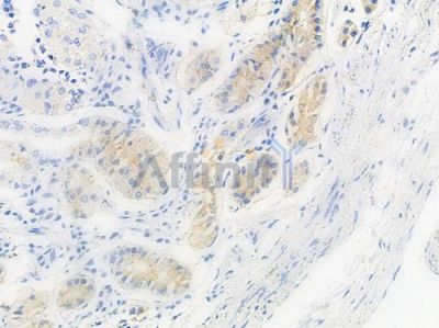 Phospho-p130 Cas (Tyr410) Antibody - AF3350 at 1/100 staining human normal gastric tissue by IHC-P.