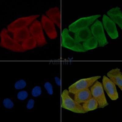 Phospho-p130 Cas (Tyr410) Antibody - AF3350 staining Hela cells(30min of UV treatment) by IF/ICC.