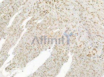 Acetyl-Histone H4 (Lys5) Antibody - AF3355 at 1/100 staining human normal colon tissue by IHC-P.