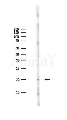 Acetyl-Histone H3 (Lys9) Antibody - Western blot analysis of lysates from PC12 cells(LPS,4h treatment), using Acetyl-Histone H3 (Lys9) Antibody at 1/1000 dilution.