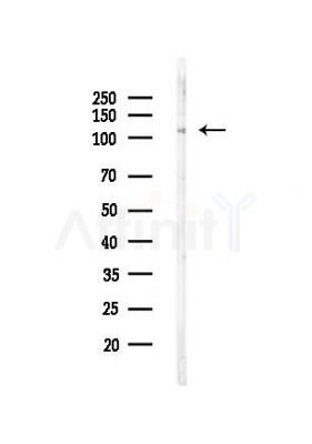 Phospho-ADAM 17 (Thr735) Antibody - Western blot analysis of lysates from PC12 cells(UV,30min treatment), using Phospho-ADAM 17 (Thr735) Antibody at 1/1000 dilution.