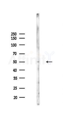 Phospho-XIAP (Ser87) Antibody - Western blot analysis of lysates from PC12 cells(UV,30min treatment), using Phospho-XIAP (Ser87) Antibody at 1/1000 dilution.