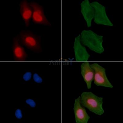 Phospho-NF kappaB p100/p52 (Ser866) Antibody - AF3373 staining Hela cells by IF/ICC.