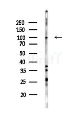 Phospho-NF kappaB p100/p52 (Ser872) Antibody - Western blot analysis of lysates from HepG2 cells(starvation,24h treatment), using Phospho-NF kappaB p100/p52 (Ser872) Antibody at 1/1000 dilution.