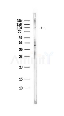 Phospho-NF kappaB p100/p52 (Ser872) Antibody - Western blot analysis of lysates from Hela cells(starvation,24h treatment), using Phospho-NF kappaB p100/p52 (Ser872) Antibody at 1/1000 dilution.